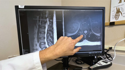 Dr. Maloney pointing out the 2- to 3-centimeter tumor on Palma&rsquo;s MRI.
