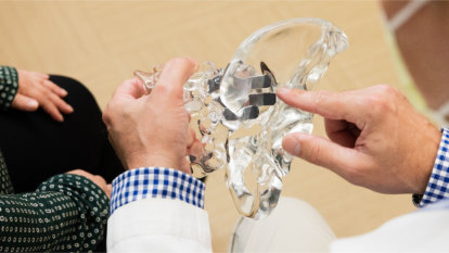 Close-up of Dr. Elmes holding a plastic model hip demonstrating the implants placed to stabilize a SI joint.